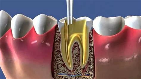 endodonti hangi bölüm